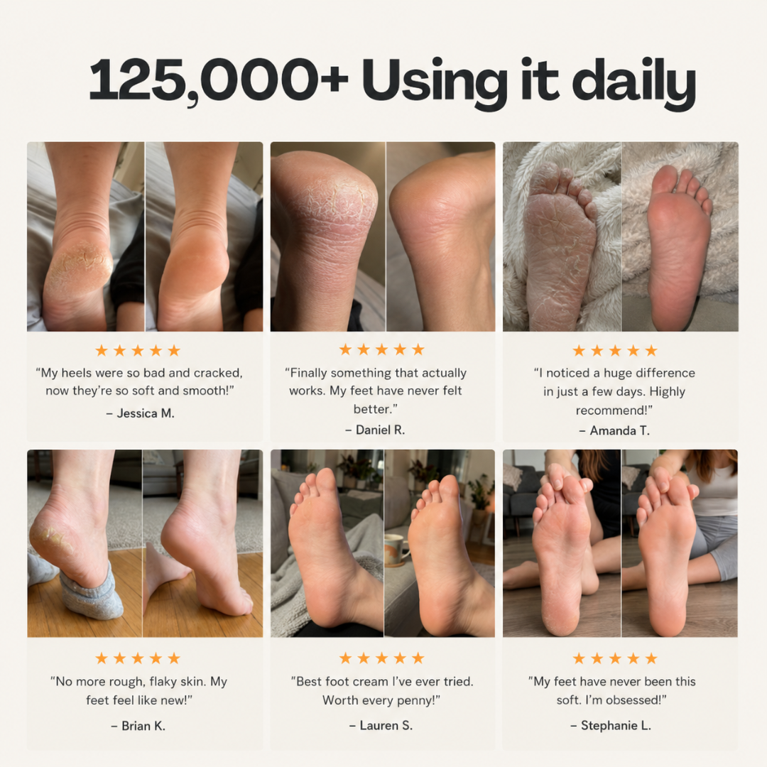 Deep-Repair Anti-Aging Heel Balm