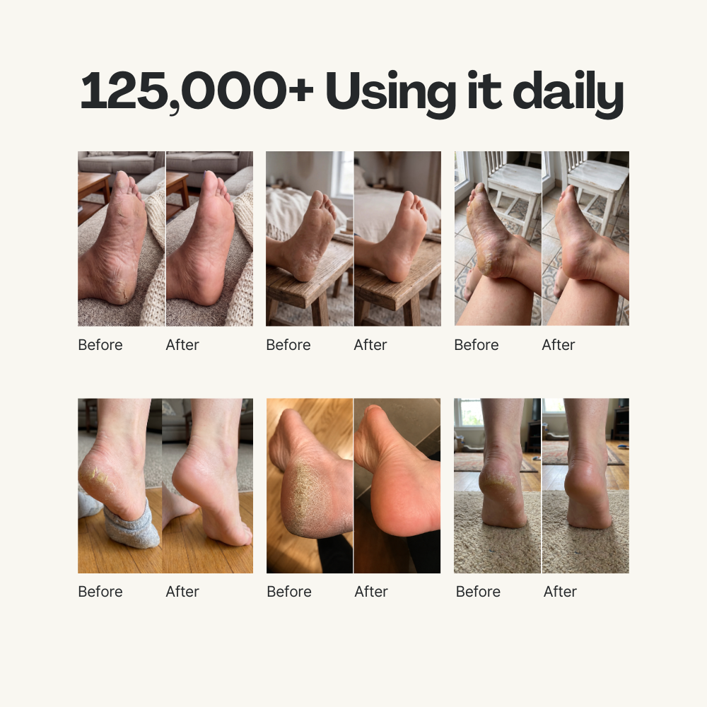 Deep-Repair Anti-Aging Heel Balm